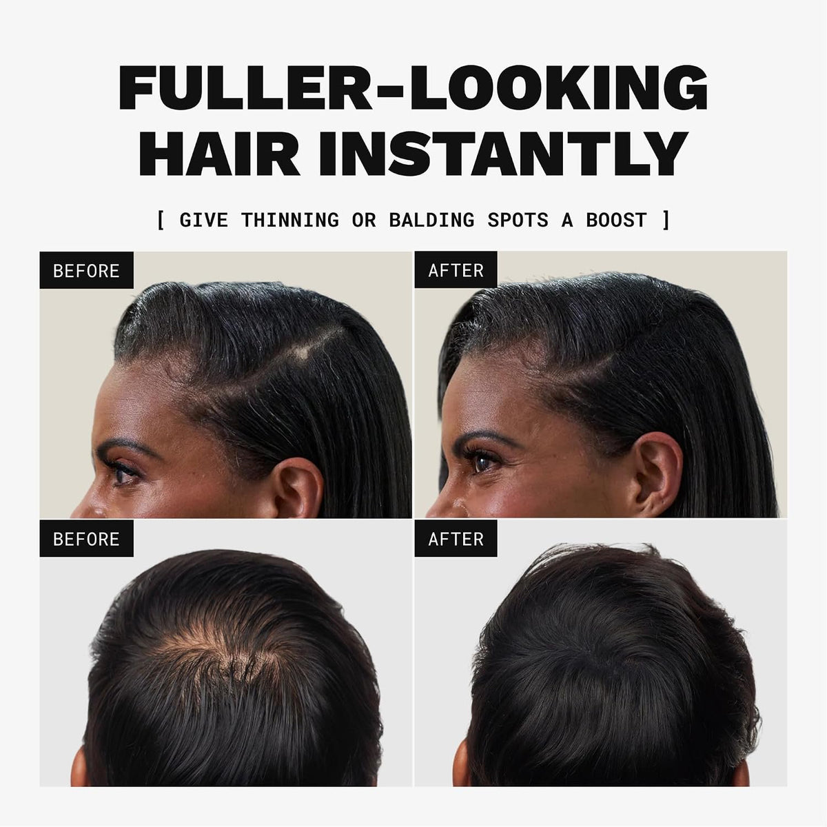 Toppik Hair Building Fibers, Medium Brown, 12g Fill In Fine or Thinning Hair, Instantly Thicker, Fuller Looking, 9 Shades for Men & Women, Keratin Protein Formula